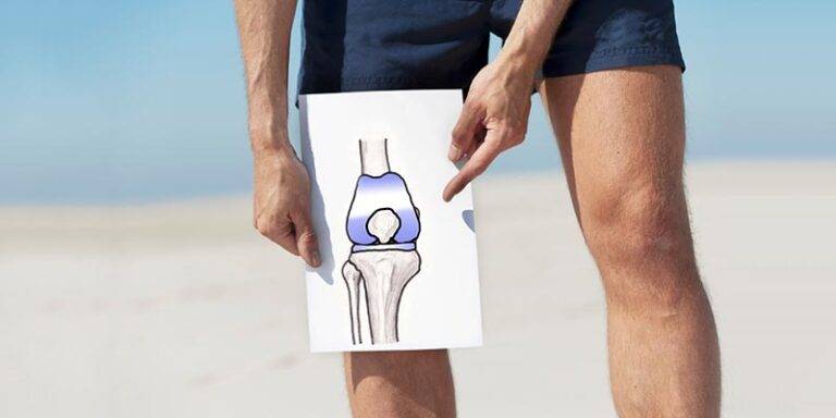 como-evitar-protese-de-joelho