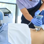 Inovação no Tratamento da Lombalgia: O Poder das Ondas de Choque Focadas (BTL)